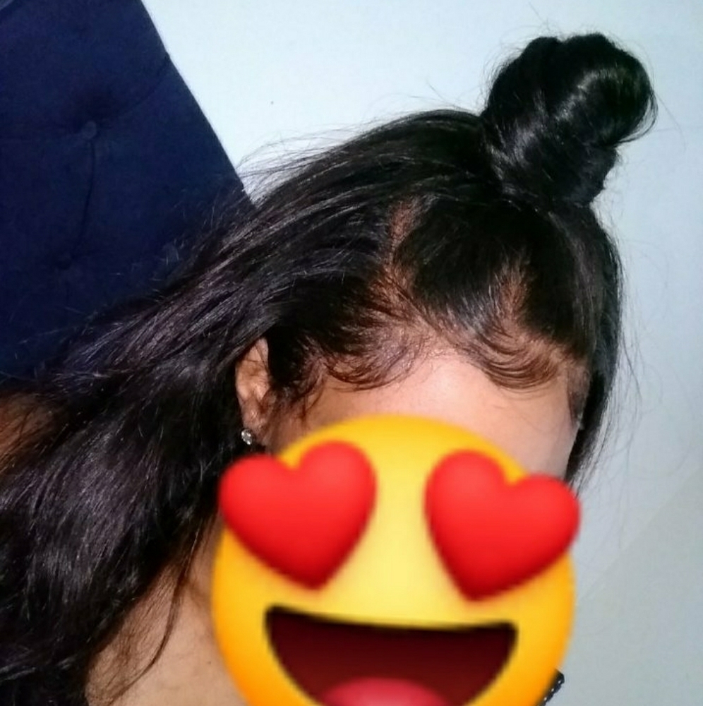 Hair